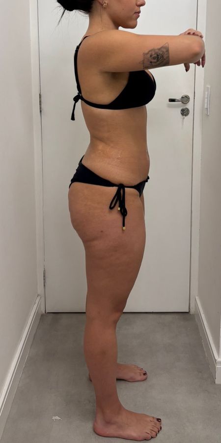 Antes do acompanhamento