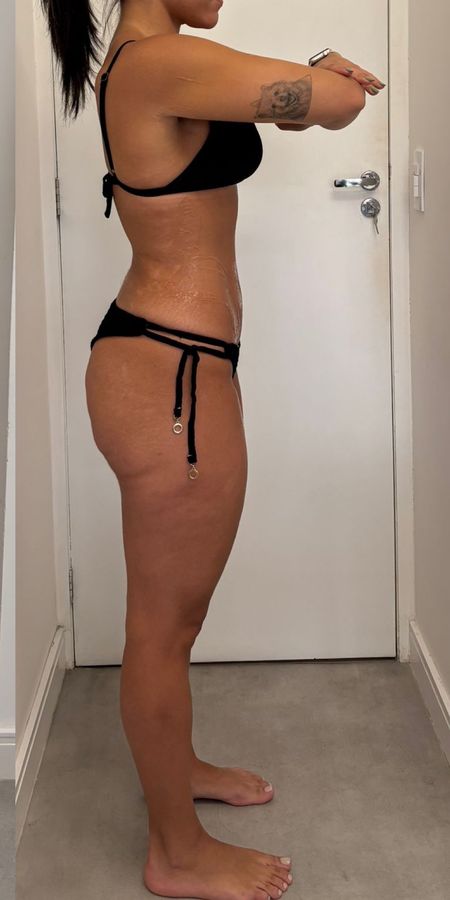 Depois do acompanhamento