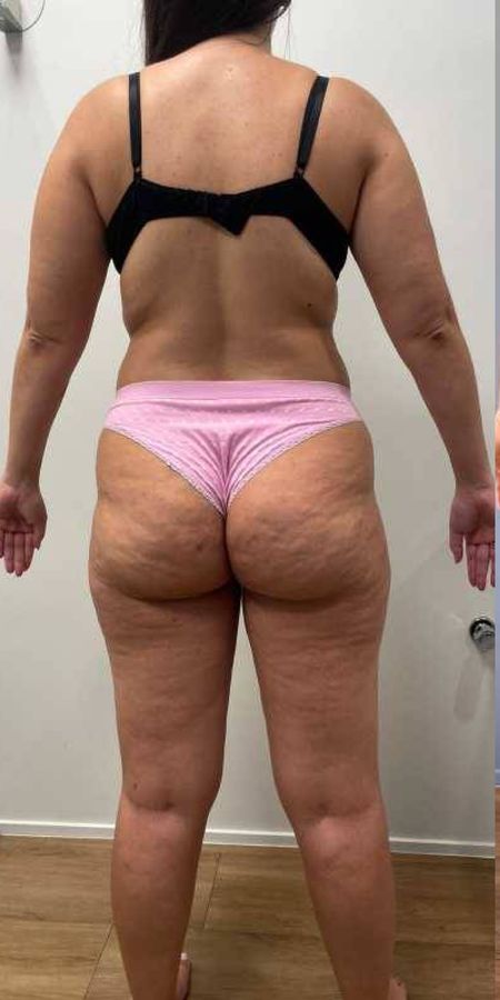 Antes do acompanhamento