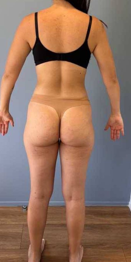 Depois do acompanhamento